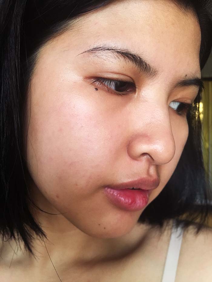 Biologique Recherche P50T: The Miracle Skin Care Product | Wonder - Day 3