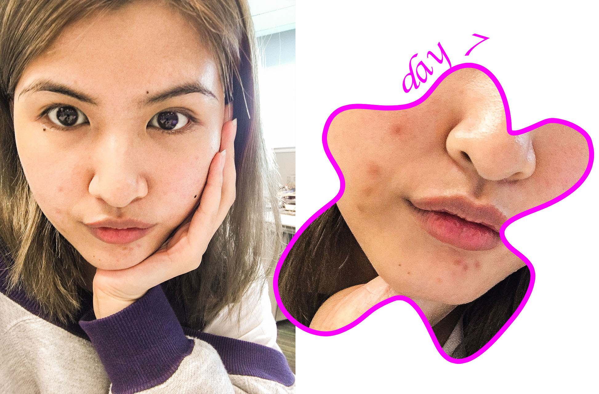 I Went on a Skincare Diet and This is What Happened